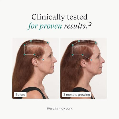 Nutrafol Women's Balance Hair Growth Supplements, Ages 45 and Up, Clinically Proven for Visibly Thicker Hair and Scalp Coverage, Dermatologist Recommended - 1 Month Supply-UPStoxs