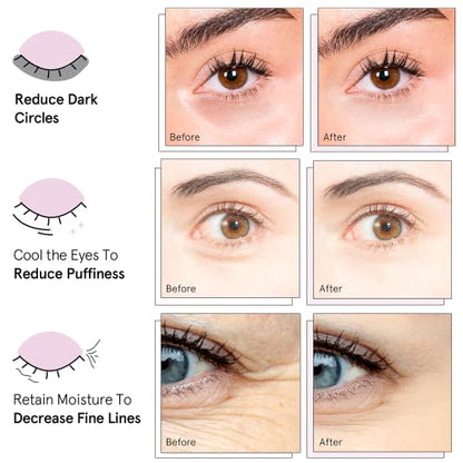 grace & stella Under Eye Mask (Gold, 24 Pairs) Reduce Dark Circles, Puffy Eyes, Undereye Bags, Wrinkles - Gel Under Eye Patches - Gifts for Women - Birthday Gifts for Women - Vegan Cruelty Free-UPStoxs